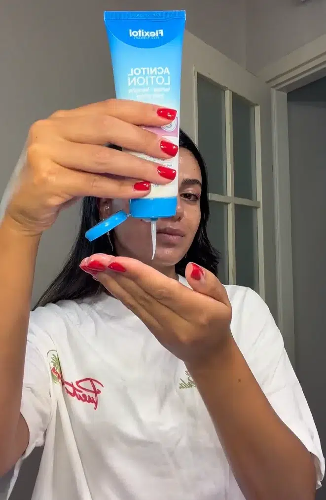 אקניטול זוהר